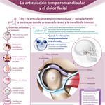 Spanish TMJ and Facial Pain Infographic PDF (La articulación temporomandibular y el dolor facial)