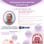 Spanish Oral Cancer Self-Exam Infographic PDF (Autoexamen para detectar el cáncer oral)