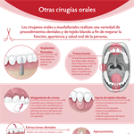 Spanish Other Oral Surgeries Infographic PDF (Otras cirugías orales)