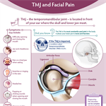 TMJ and Facial Pain Infographic (PDF) 