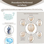 Craniofacial Surgery Infographic (PDF)