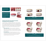 Dental Implant Surgery Patient Education Guide (25-Pack)