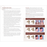 Corrective Jaw Surgery Patient Education Guide (25-Pack)