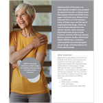 Medication-related Osteonecrosis of the Jaw (MRONJ) Patient Information Pamphlet (100-Pack)