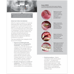 Medication-related Osteonecrosis of the Jaw (MRONJ) Patient Information Pamphlet (100-Pack)