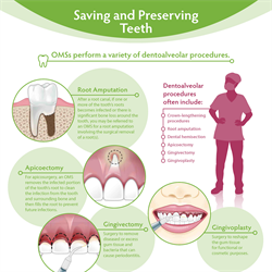 Saving and Preserving Teeth (PDF)