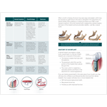 Dental Implant Surgery and Wisdom Teeth Management Patient Education Guide Bundle