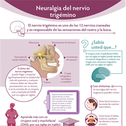 Spanish Trigeminal Nerve Pain PDF (Neuralgia del nervio trigémino)
