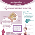 Spanish Trigeminal Nerve Pain PDF (Neuralgia del nervio trigémino)